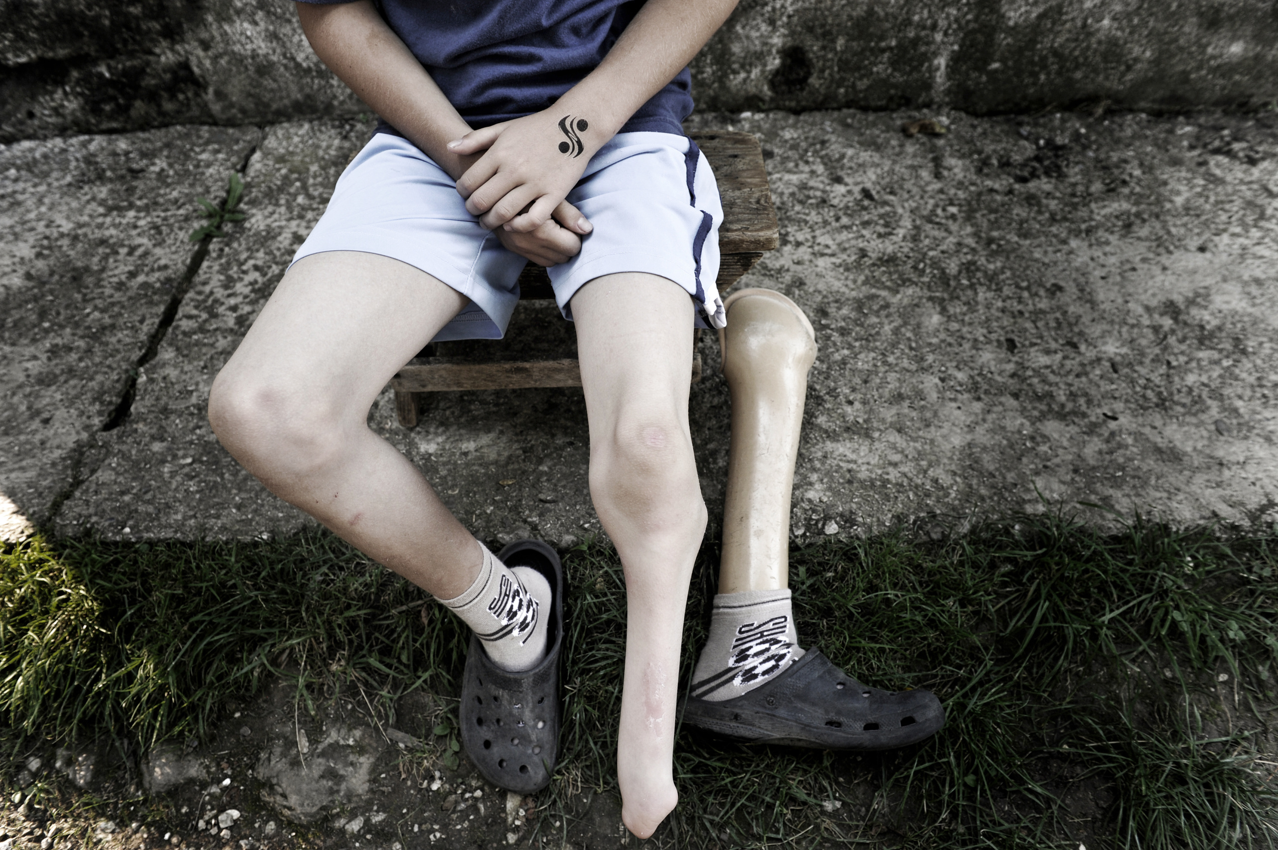 BOSNIA
Legacy of war.
Pictures taken for the NGO Miracles near Mostar in 2012.